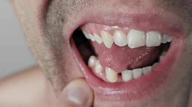 Close-up of an unshaven man inspecting his teeth. He uses a finger to pull down his lower lip, revealing gums and touching his canine tooth with his tongue, a dental self-check.