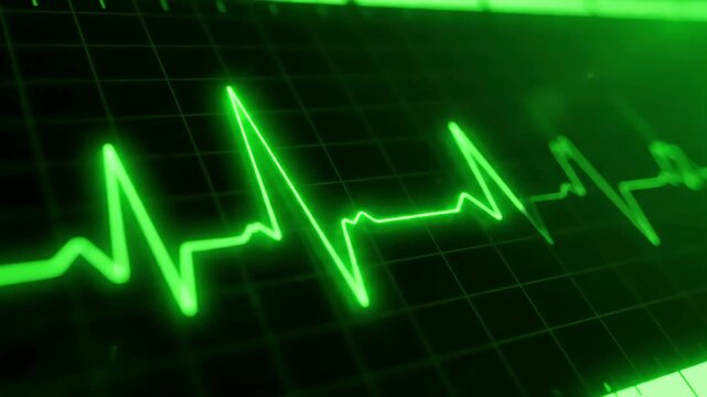 Green Screen 3d render of a heartbeat frequency on cardiograph recording pulse scene 4 with distortion, overlay, glitch, static noise, scan lines black background, 4k animated video loop