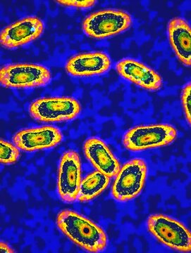 Microbial animation Yersinia pestis bacteria motion microscopy biomedical visualization