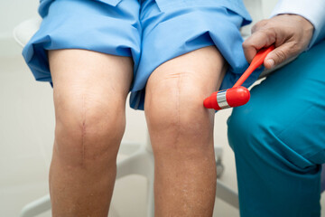 Asian doctor knock on knee reflex nerve for check and treatment senior patient in hospital.