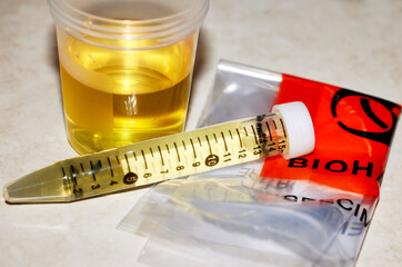 Urine Sample with Biohazard Bag