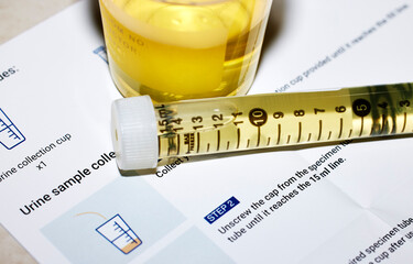 Urine Sample with Instructions