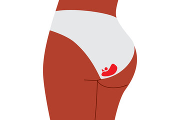 Dark-skinned woman in white underwear with period stain. Vector illustration promoting menstrual health, body positivity, self-acceptance and normalizing periods. Isolated high resolution PNG 