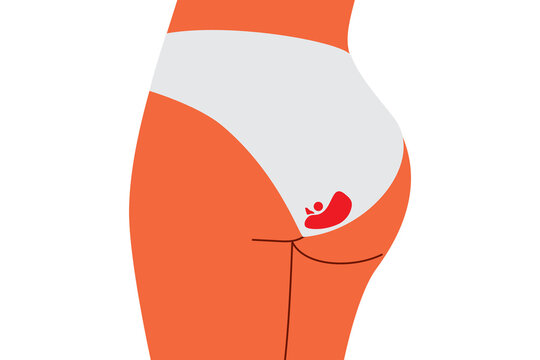 Female bottom in off white underwear with period stain. Vector illustration promoting menstrual health, body positivity and normalizing menstruation. Empowering women and breaking taboos. High-res PNG