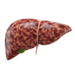 A realistic 3d render of a diseased human liver with a mottled, textured surface, isolated on a transparent background