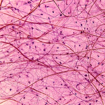 Microscopic view of connective tissue with collagen fibers and fibroblasts.
