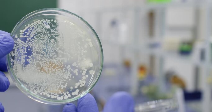 A scientist shows a close-up of a petri dish containing white bacterial colonies against a laboratory background. - Powered by Adobe