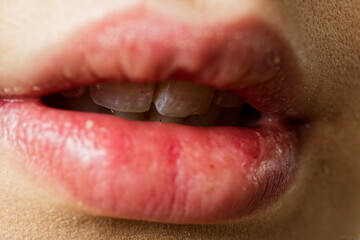 Obraz premium Open Mouth Showing Teeth With Dental Work Close-Up Of