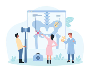 Osteoporosis, diagnosis, treatment and rehabilitation in rheumatology vector illustration. Cartoon tiny people study human hip joint on medical anatomy chart, orthopedist holding bone calcium puzzle