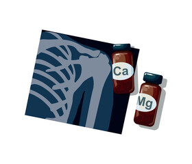 Chest X Ray and glass bottle with pills on white background. Image Diagnostic Healthcare Tool.