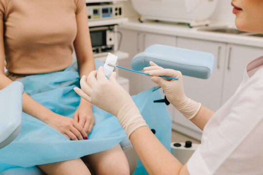 Cervical cells are applied to a microscope slide for examination. A Pap smear sample on a slide for testing. Gynecologist prepares a cytology slide using a sterile brush.