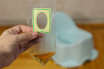 Urine test container for young children. Laboratory test, close-up of hand. Urine bag
