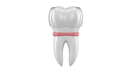 Isolated illustration of a molar tooth with a dental crown and gum inflammation