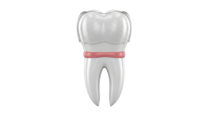 Isolated illustration of a molar tooth with a dental crown and gum inflammation
