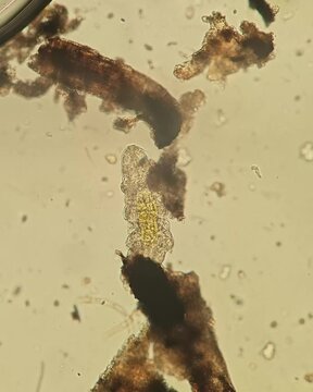 Tardigrade under brightfield microscope at 100x&ndash;200x magnification &ndash; microscopic video of a water bear