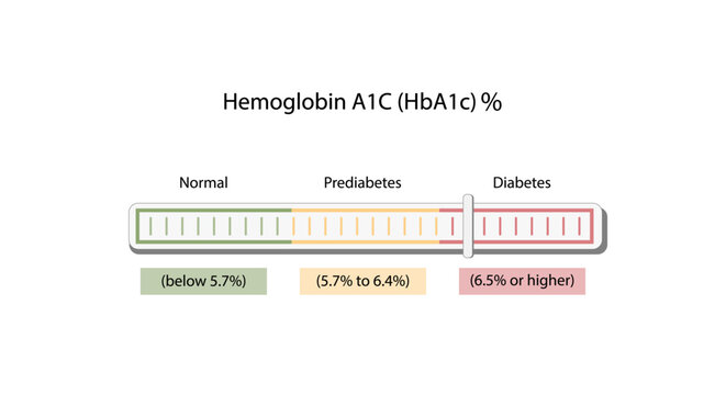 Hemoglobin A1C, HbA1c test , HbA1c levels, Glucose sticks to hemoglobin, glycated hemoglobin, up to 120 days. A1C Blood Sugar Test, Diabetes Mellitus, Infographic, Vector illustration.
