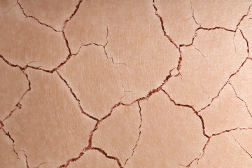 Dry skin presented as double exposure with cracked soil