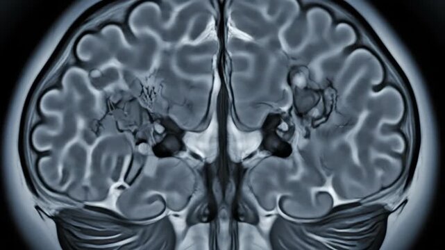 Dynamic brain scan reveals intricate neural pathways for medical research and educational resources about neurology and brain health