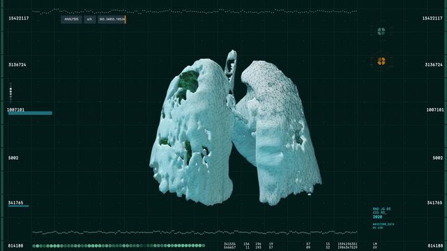 Epidemic Covid Infection Research By Modern Medical Software Interface. Futuristic Laboratory Scanning Interface Analyzes Epidemic Infected Lungs. Epidemic Coronavirus Infection On Digital Interface.