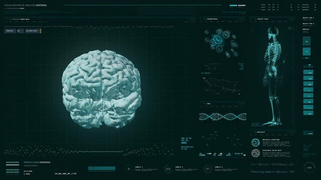 High Tech Diagnostic Interface Conducts Analysis Of Patients Brain Health. Innovative Brain Analysis Diagnostic Interface. Medical Diagnostic Interface For Brain Scanning. Medical Examination