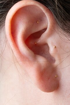 Macro portrait of female ear with auricular acupressure seeds, a non-invasive therapy rooted in traditional medicine for tension and emotional balance.