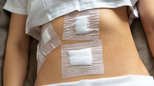 Young woman's belly after surgical operation by laparoscopy in hospital, patient with bandaging in clinic, concept of gallbladder and myoma