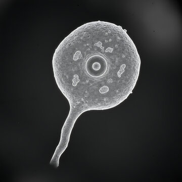 Micrograph of an isolated unipolar neuron. 