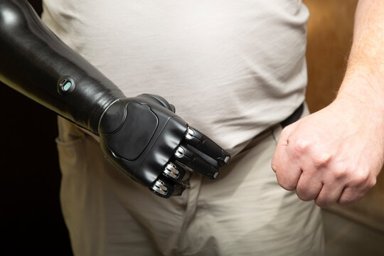 Prosthetic arm for an amputated arm. Cyber arm. The arm is controlled by the person's mind.