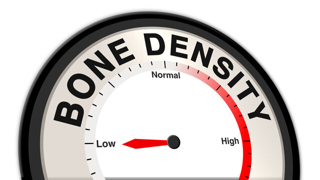 Bone density at low levels displayed on a barometer or tachometer, representing weakened skeletal strength, increased fracture risk, and ongoing monitoring for bone health and prevention