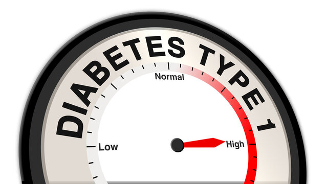Diabetes Type 1 at high severity displayed on a barometer or tachometer, showing severe symptoms like extreme thirst, weight loss, high blood sugar, and risk of diabetic ketoacidosis, requiring urgent