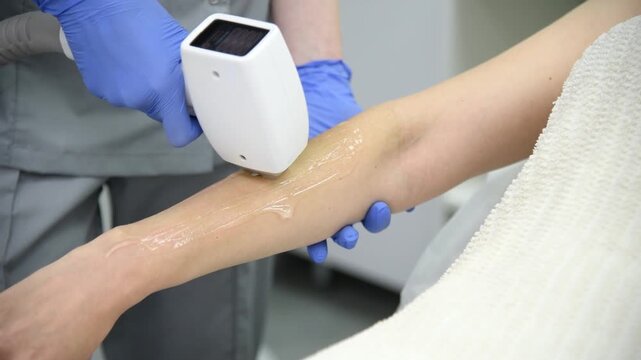 laser epilation, hair removal procedure, young beautiful caucasian smiling brunette woman lying on couch in beauty salon, arm epilation, spa and cosmetology concept