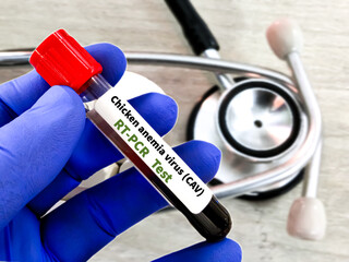 Chicken anemia virus (CAV) diagnosis of biological specimen at laboratory. It's scientific name...