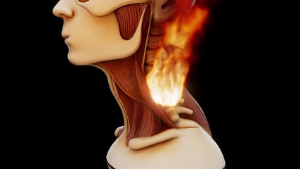 Conceptual 3D animation of a neck strain on fire