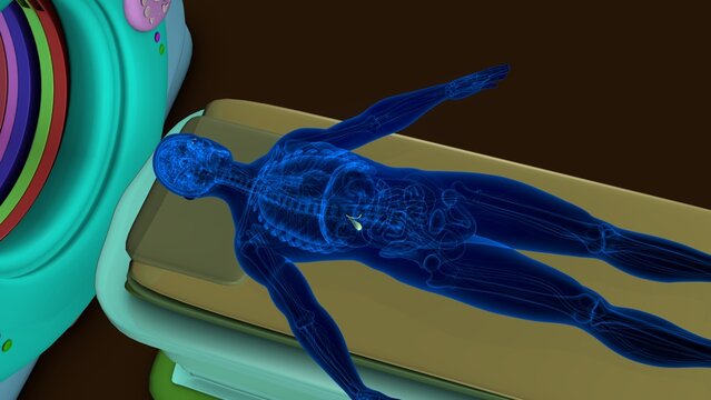 CT scan gallbladder anatomy. 3d illustrations