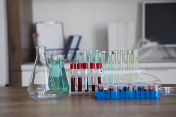 Different chemical glassware and test tubes on table in medical laboratory