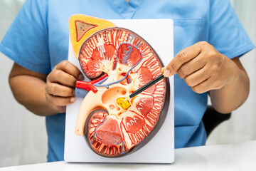 Kidney disease, Chronic kidney disease ckd, Doctor hold human model to treat and study in hospital.