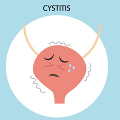 Medical vector illustration of cystitis showing bladder pain, burning urination, urgency, and discomfort. Includes comparisons with urethritis and kidney infection symptoms. crying