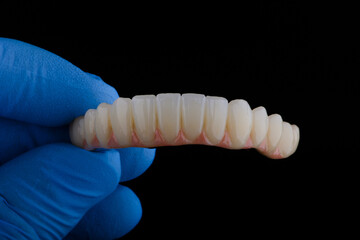 Full dental zirconium prosthesis on titanium bar stained with stains for ceramic.