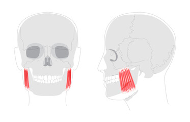 Masseter - Human chewing muscle shown in diagram responsible for elevating the mandible, crucial for biting and grinding, depicted in medical illustration for dental and anatomical education.