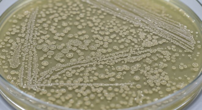 Bacterial colonies form circular patterns on a petri dish displaying density and uniform growth