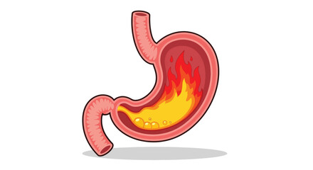 Fototapeta premium Anatomical Illustration of a Human Stomach with Internal Fire and Acid.