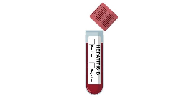 Animated Hepatitis B test tube showing a negative result with a tick box. Hepatitis or liver disease diagnosing test and medical laboratory concept.