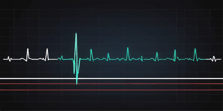 EKG heart monitor displaying a green heartbeat line, illustrating medical technology and cardiology healthcare