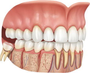 wisdom teeth healthy medical care dental human mouth illustration