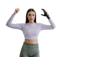 Cute young woman stands at home with  bionic hand prosthesis, smiles, bending hands looks aside on transparent background.