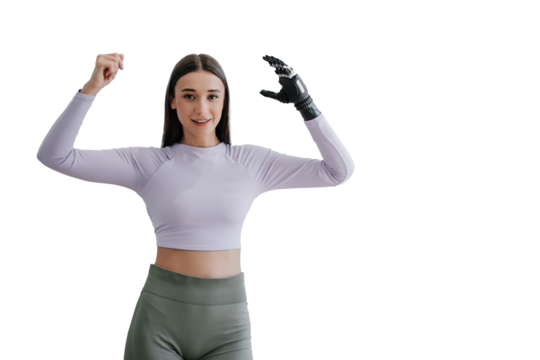 Cute young woman stands at home with  bionic hand prosthesis, smiles, bending hands looks aside on transparent background.