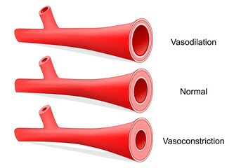 Vasoconstriction, Vasodilation, and normal artery. Comparison of normal, constricted, and dilated blood vessels