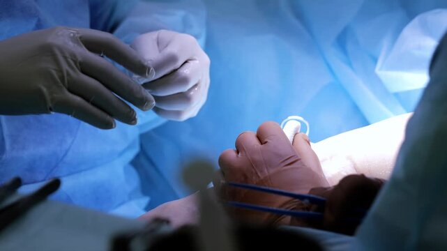 Surgical team performing delicate limb operation, showing teamwork and skill during complex medical intervention in modern operating theater