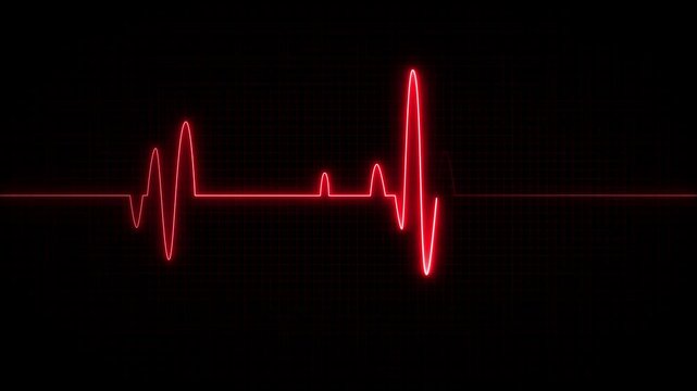 Heartbeat pulse line animation . medical health monitoring electrocardiogram signal . glowing blue ekg waveform on dark grid technology background . 4k motion graphic video. on black background. - Powered by Adobe