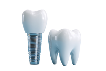 Dental implant and natural tooth model displayed side by side in a clinical setting for dental education or demonstration purposes Generative AI